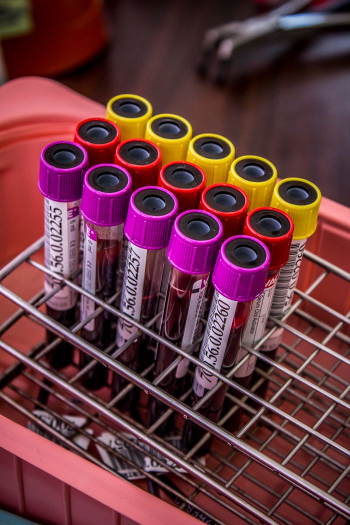 Close-up of colorful blood test tubes in a metal rack for laboratory analysis.