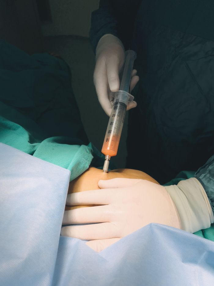 Doctor performs injection procedure, highlighting healthcare precision.
